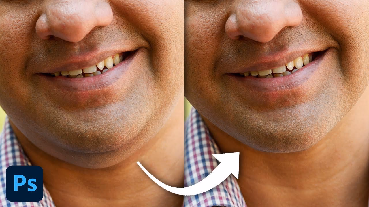 How to remove a double chin?