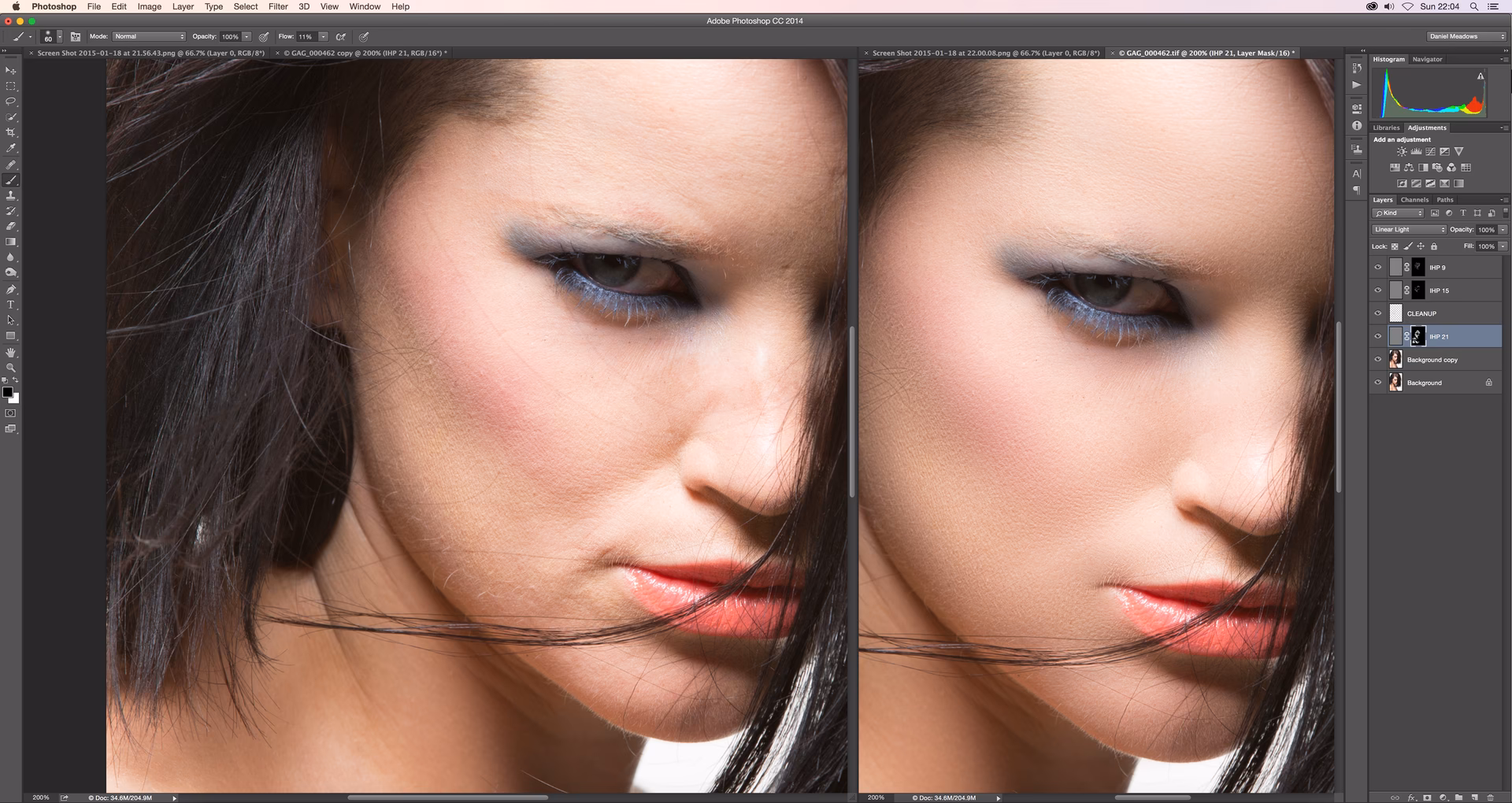 What is the purpose of a high pass filter?