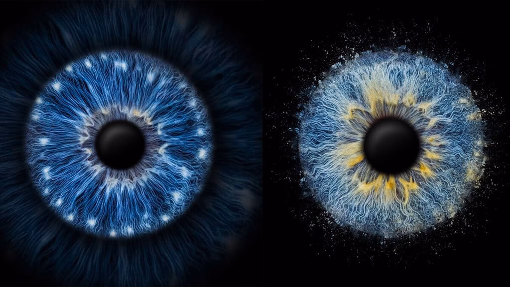 Wie hoch sind die Kosten für IRIS-T SLM?