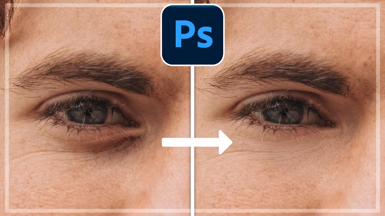 Wie kann man Augenringe auf Fotos entfernen?