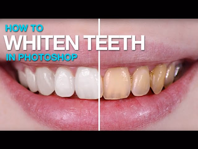 How to whiten teeth in Photoshop 2025?